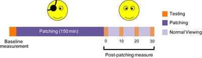 Short-Term Deprivation Does Not Influence Monocular or Dichoptic Temporal Synchrony at Low Temporal Frequency